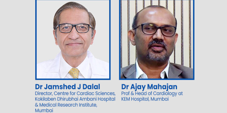 Experts encourage people to increase adoption of stair climbing for cardiovascular fitness as studies suggest