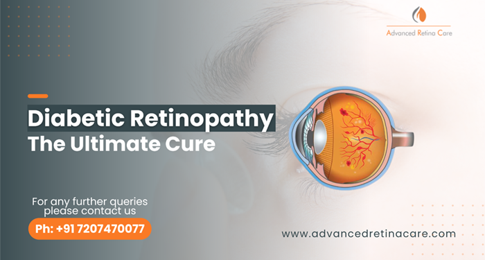 Diabetic Retinopathy - The Ultimate Cure!