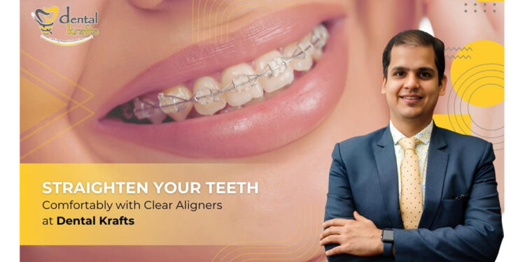 Straighten Your Teeth Comfortably with Clear Aligners at Dental Krafts