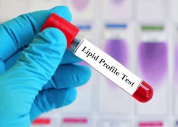 Why Regular Lipid Profile Tests Are Crucial for Heart Health